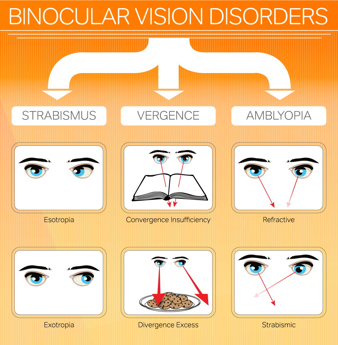 Binocular Vision Disorders Infographic