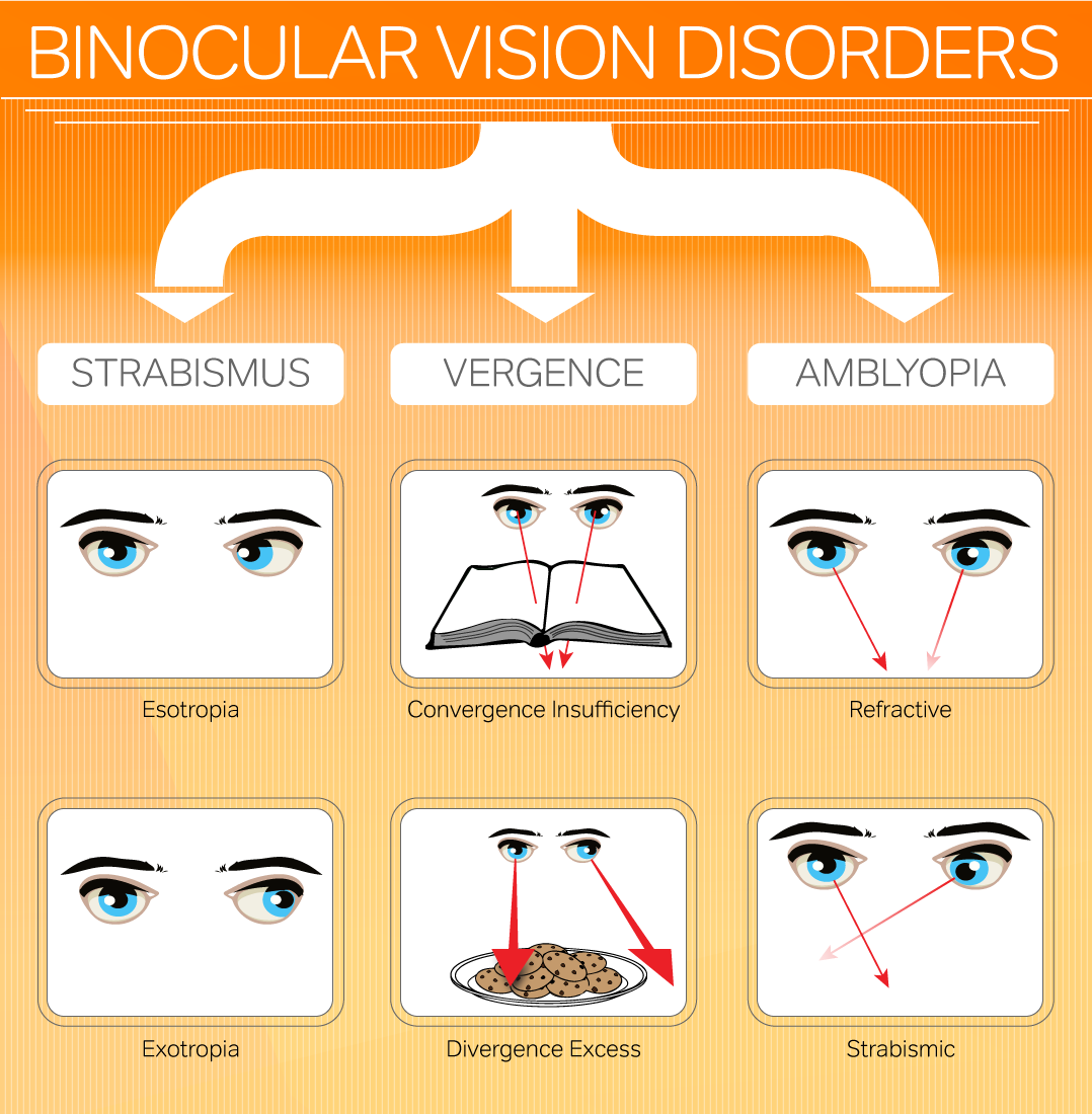 functional movement disorder